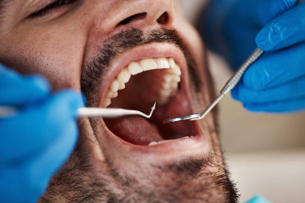 Best Emergency TMJ Treatment in Astia, OR